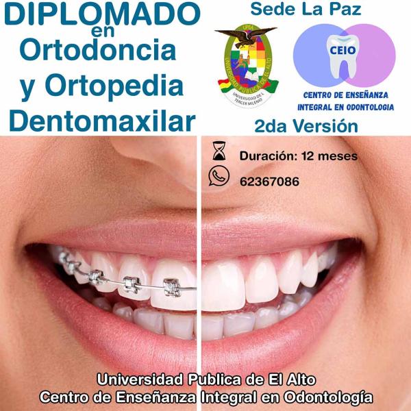 Anuncio Diplomado